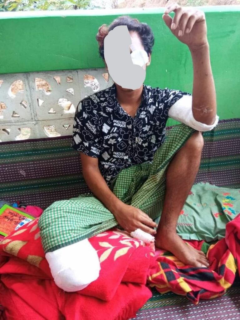 ဂန့်ဂေါပြည်သူ့ကာကွယ်ရေးတပ်(PDF)