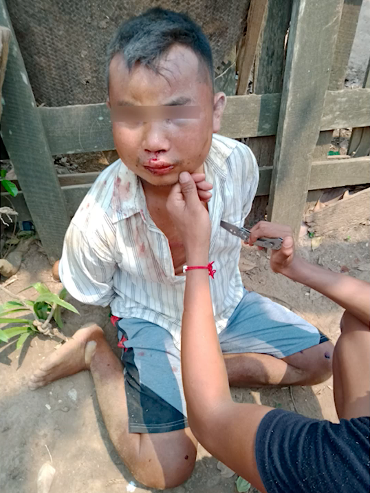 အရာတော်ဒေသခံ ကောက်ရထားသည့် စစ်ကောင်စီတပ်သား၏ ဖုန်း၌ အရပ်သားများစွာကို လက်ပြန်ကြိုးတုပ်ဖမ်းထားခြင်း၊ သတ်ဖြတ်ခြင်း ဓာတ်ပုံစသော စစ်ရာဇဝတ်မှုများကို စိတ်လိုလက်ရကျူးလွန်ကြောင်း အထောက်အထား ရုပ်သံမှတ်တမ်းများပါဝင်