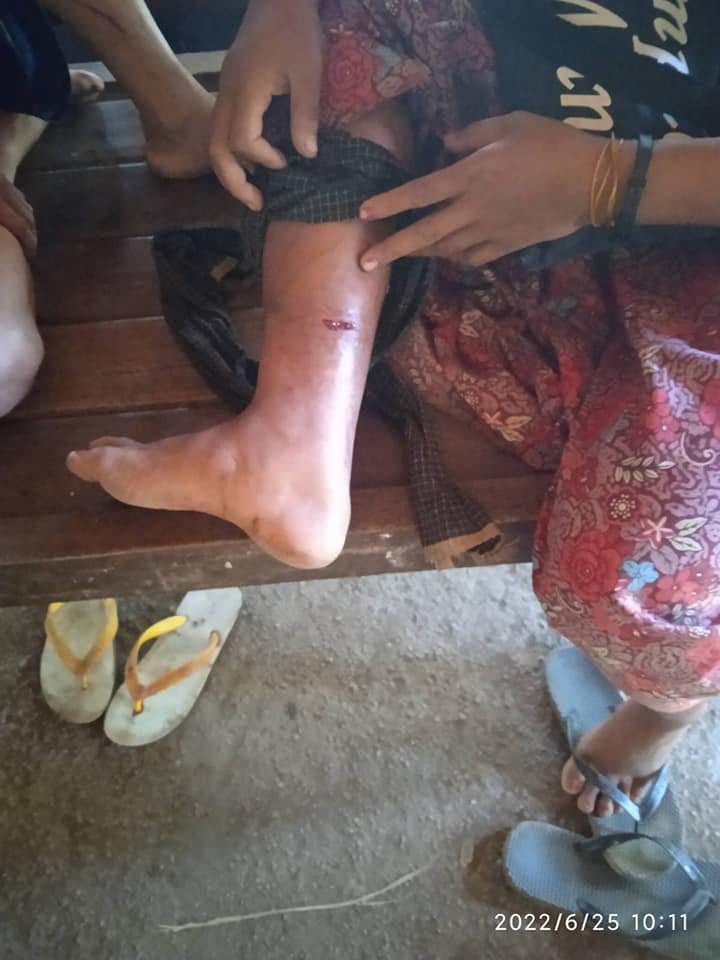 စစ်ကောင်စီက ကျေးရွာထဲကို လက်နက်ကြီးပစ်ခတ်