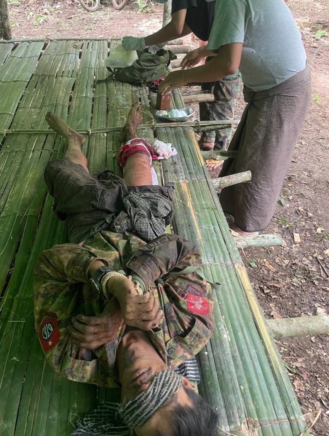 ဒဏ်ရာရစကစတပ်သားကို ဆေးကုသပေးနေစဥ်၊ ဓာတ်ပုံ - ကာကွယ်ရေးဝန်ကြီးဌာန အမျိုးသားညီညွတ်ရေးအစိုးရ