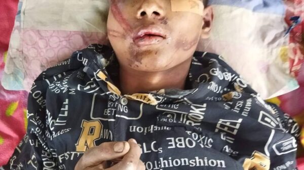 မုံရွာမြို့တွင် စစ်ကောင်စီက ရိုက်နှက်စွန့်ပစ်ထားသည့် လူငယ်တစ်ဦးကို ပြည်သူ့ကာကွယ်ရေးတပ်ဖွဲ့က ကယ်ဆယ်ကုသပေး