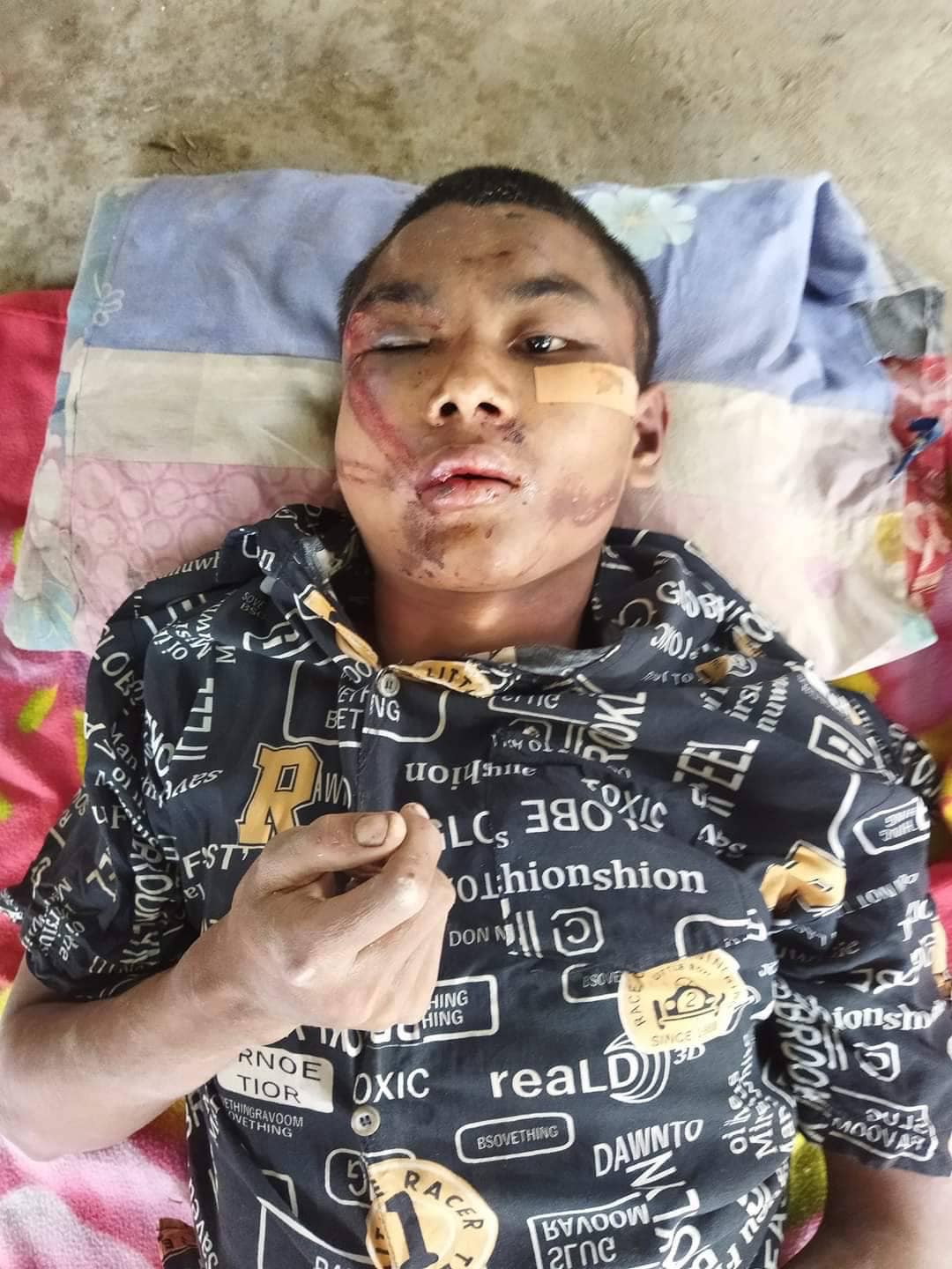 မုံရွာမြို့တွင် စစ်ကောင်စီက ရိုက်နှက်စွန့်ပစ်ထားသည့် လူငယ်တစ်ဦးကို ပြည်သူ့ကာကွယ်ရေးတပ်ဖွဲ့က ကယ်ဆယ်ကုသပေး