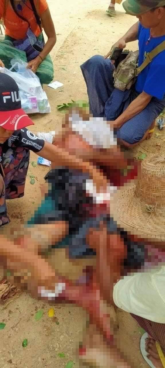 (ယမန်နေ့မွန်းလွဲပိုင်းက စစ်ကောင်စီတပ် လက်နက်ကြီးဖြင့် ပစ်ခတ်ခဲ့၍ ဇီးကျွန်းရွာ၌ သေဆုံးခဲ့သူတစ်ဦးအား တွေ့ရစဥ်၊ ဓာတ်ပုံ - CDSOM)