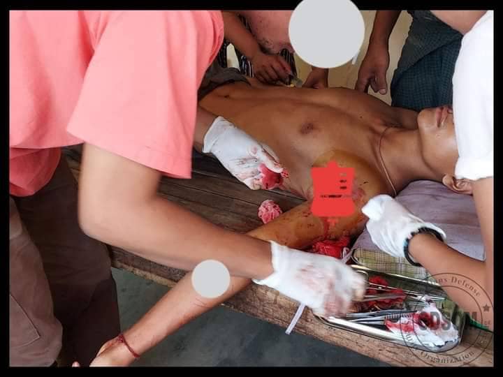ဒဏ်ရာရခဲ့သည့် ရဲဘော်အား ဆေးကုသမှုပေးနေစဉ်
