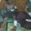 အမရပူရ က ယက်ကန်းအထည်ဆိုင်မှာ ဗုံးပေါက်ကွဲမှုဖြစ်ပြီး ၁ ဦးသေဆုံးကာ ၃ ဦးထိခိုက်ဒဏ်ရာရ