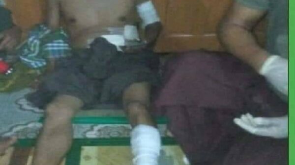 အမရပူရ က ယက်ကန်းအထည်ဆိုင်မှာ ဗုံးပေါက်ကွဲမှုဖြစ်ပြီး ၁ ဦးသေဆုံးကာ ၃ ဦးထိခိုက်ဒဏ်ရာရ