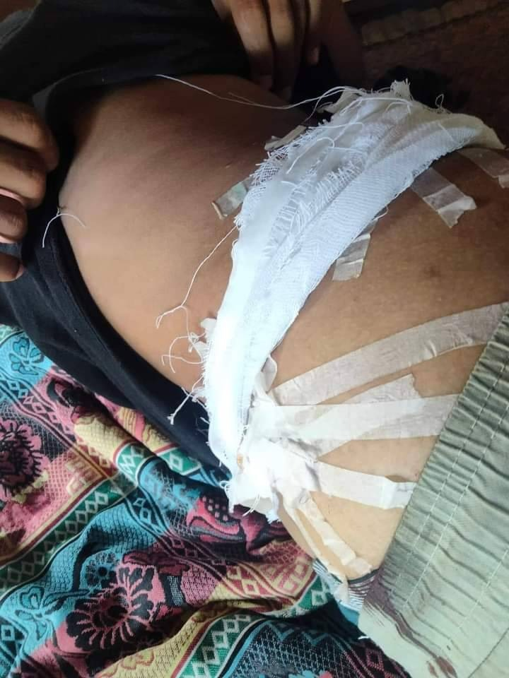 တိုက်ခိုက်ခဲ့သော PDFရဲဘော်များနှင့် ထိခိုက်ဒဏ်ရာရရှိခဲ့သော ရဲဘော်တစ်ဦးအား ဆေးကုသမှုပေးနေစဥ်။ ဓာတ်ပုံ - MG 6ပြောက်ကျားတပ်ဖွဲ့