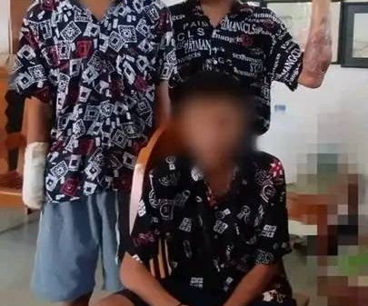 (ဒဏ်ရာပြင်းထန်စွာရရှိပြီး ဆေးကုသမှုခံယူခဲ့သည့် ရဲဘော် သုံးဦးအား တွေ့ရစဥ်၊ဓာတ်ပုံ-Myanmar Defense Force)