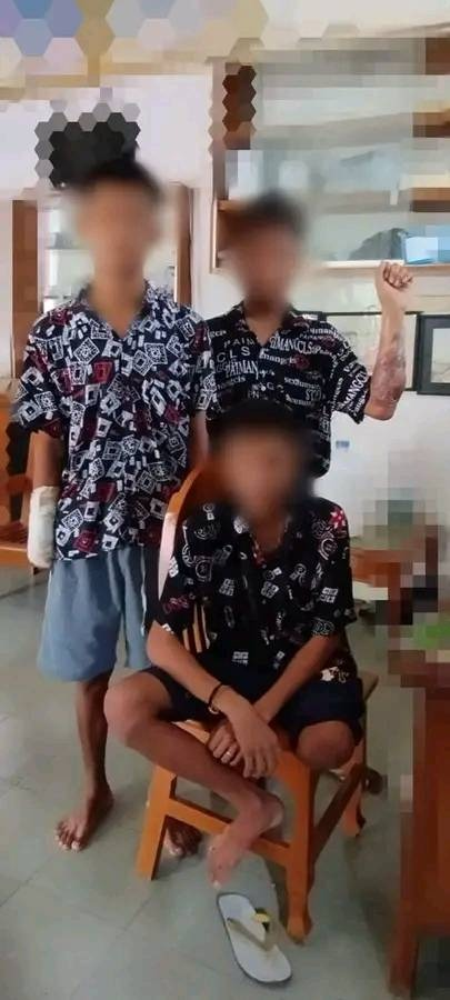 (ဒဏ်ရာပြင်းထန်စွာရရှိပြီး ဆေးကုသမှုခံယူခဲ့သည့် ရဲဘော် သုံးဦးအား တွေ့ရစဥ်၊ဓာတ်ပုံ-Myanmar Defense Force)