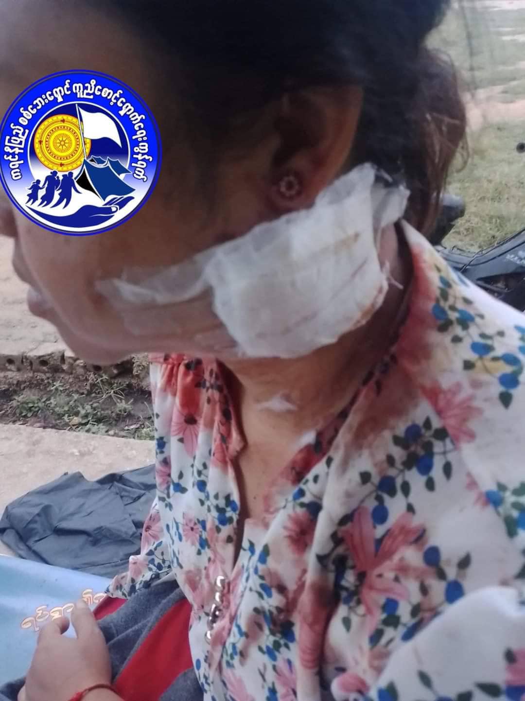 (ယနေ့ နံနက်ပိုင်း စစ်ကောင်စီတပ် ပစ်ခတ်မှုကြောင့် သေဆုံး၊ဒဏ်ရာရရှိသူများနှင့် မွေတော်ဘုရား ကျောင်းဆောင်အား တွေ့ရစဉ်၊ ဓာတ်ပုံ - ကရင်နီစစ်ဘေးရှောင် ကူညီစောင့်ရှောက်ရေးကွန်ရက်၊ PKPF)