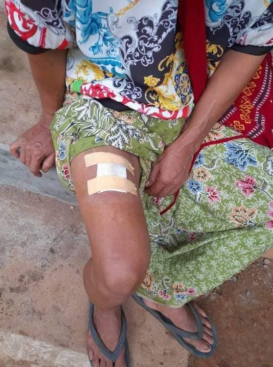 "အရပ်သား(၃)ဦး ထိခိုက်ဒဏ်ရာရသည့်အပြင် နွားတစ်ကောင် ဆိတ်တစ်ကောင်လည်း လက်နက်ကြီးစထမှန်ခဲ့သေးသည်" ဟု ကေအဲန်ယူ၏ ထုတ်ပြန်ချက်တွင်ဖော်ပြထားသည်။
