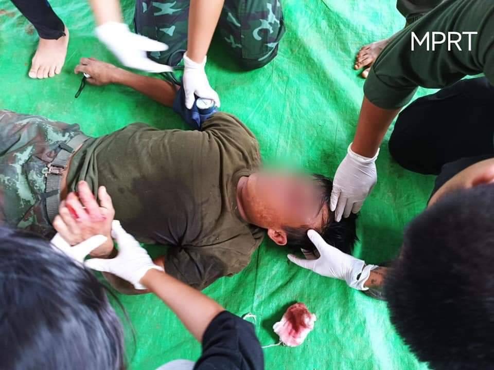 (ဒဏ်ရာရရှိသည့် ရဲဘော်များအား ဆေးကုသပေးနေစဉ်၊ ဓာတ်ပုံ - Mobye PDF Rescue Team-MPRT)