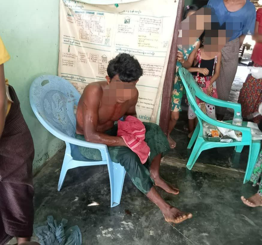 (စစ်ကောင်စီတပ်မှ လက်နက်ကြီးပစ်ခတ်မှုကြောင့် ဖလောင်းပြင်ကျေးရွာက ဒဏ်ရာရရှိခဲ့သူများ၊ဓာတ်ပုံ-Western News- WN)