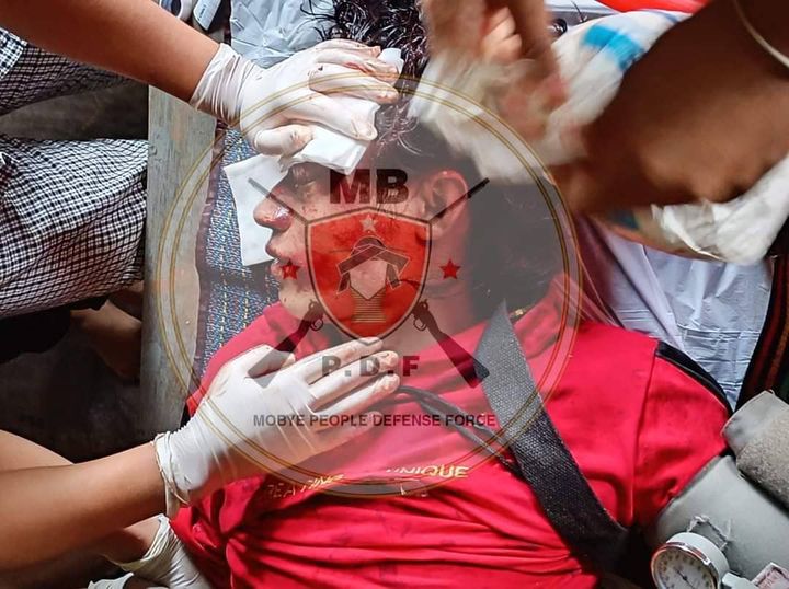 (စစ်ကောင်စီ၏ ပစ်ခတ်မှုကြောင့် ဒဏ်ရာရရှိခဲ့သည့် အမျိုးသားတစ်ဦးကို MBPDFက ဆေးကုသ ပေးနေစဉ်၊ ဓာတ်ပုံ - MPDF)