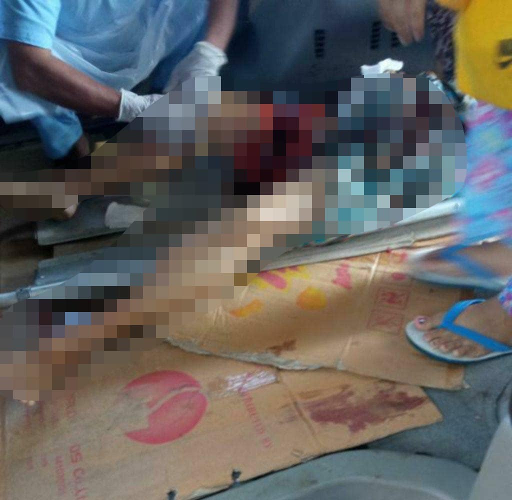(ဒဏ်ရာရရှိသည့် ဒေသခံများအား တွေ့ရစဉ်၊ ဓာတ်ပုံ - CJ)