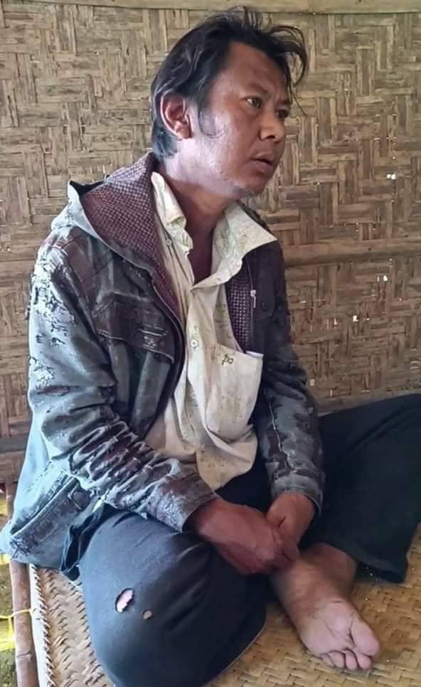 ချန်ထားခံခဲ့ရသော လေဖြတ်လူနာ ရဲဒုတပ်ကြပ်၊ ဗဟင်းကျေးရွာနှင့်ရဲစခန်းအား မီးရှို့ဖျက်ဆီးသွားစဥ်၊ ဓာတ်ပုံ- နွေဦးတော်လှန်ရေး-မြိုင်