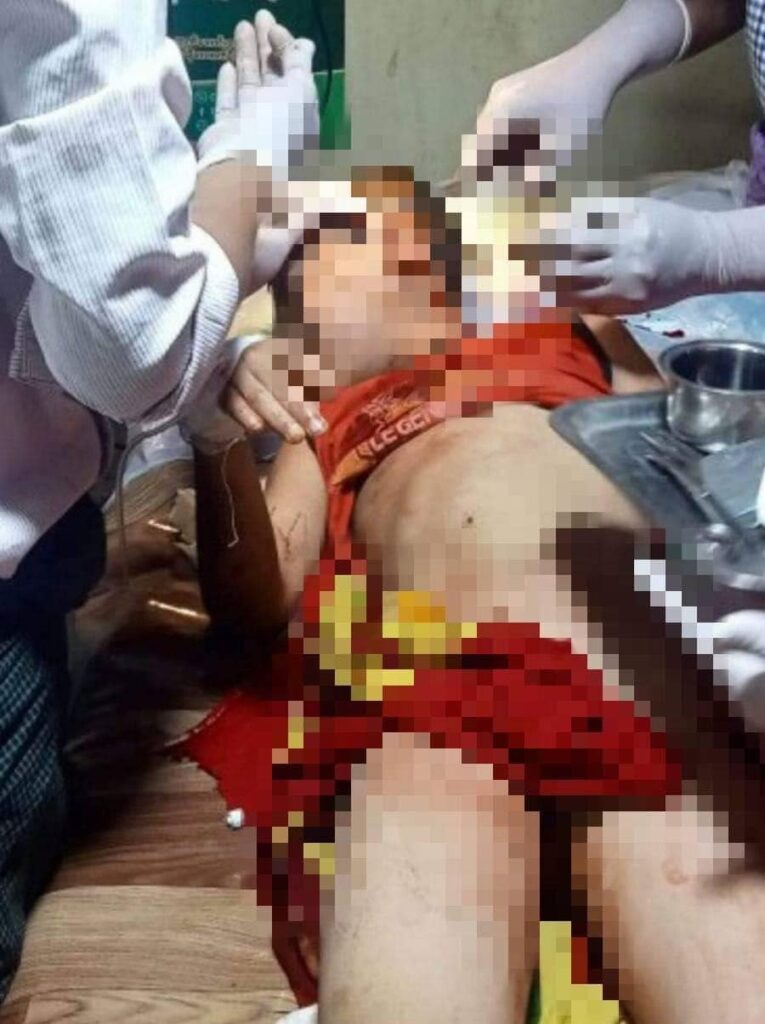 (ကလေးငယ်များအပါအဝင် အရပ်သားများထိခိုက်ဒဏ်ရာရရှိမှုအား တွေ့ရစဥ်၊ ဓာတ်ပုံ - KNU)