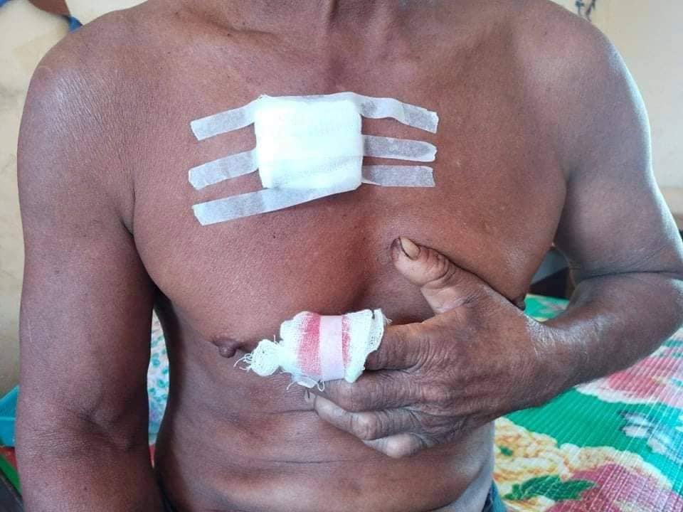 ကျေးရွာထဲလက်နက်ကြီးကျပြီး အရပ်သားတစ်ဦးဒဏ်ရာရရကာ နေအိမ်အချို့ပျက်စီး