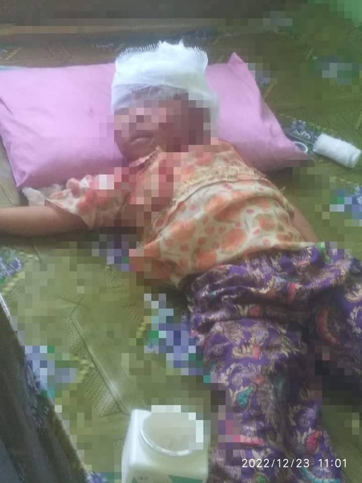 ဆုံးပါးသွားသည့်ကလေးငယ်အား တွေ့ရစဥ်၊ ဓာတ်ပုံ-Ko Nway Oo (Myaung)