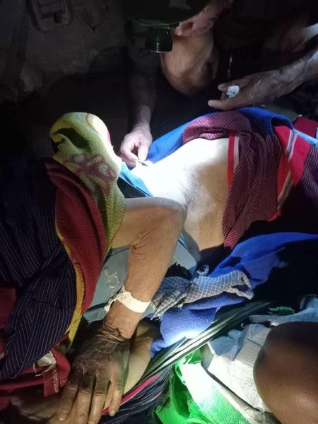 ကော်သူးလေအတွင်းရှိ ကျေးရွာနှစ်ဆယ်ကျော် လေကြောင်းတိုက်ခိုက်မှုဆိုးဆိုးရွားရွားခံနေရ