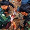 (စစ်ကောင်စီ၏ လေကြောင်းနှင့် လက်နက်ကြီးကြောင့် ထိခိုက်ဒဏ်ရာရရှိခဲ့သော ရဲဘော်အား ဆေးကုသမှုပေးနေစဥ်။ ဓာတ်ပုံ - MPRT)