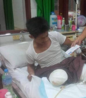 (​နေပြည်​တော် ကုတင်၁၀၀၀ စစ်​ဆေးရုံတွင်​ဆေးဝါးကုသမှုခံယူ​နေ​သော ​စစ်​သားအချို့ ။ဓါတ်ပုံ-Thar Htet Nyan)