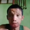 (ကရင်နီတိုက်ပွဲမှ အမာရွတ်များကိုပြသ​နေ​သောစစ်​ကောင်စီတပ်သား တပ်ကြပ်ဇင်မင်းထက်အောင်။ ဓါတ်ပုံ-ဇင်မင်းထက်​အောင်၏ရုပ်သံဖိုင်မှ)