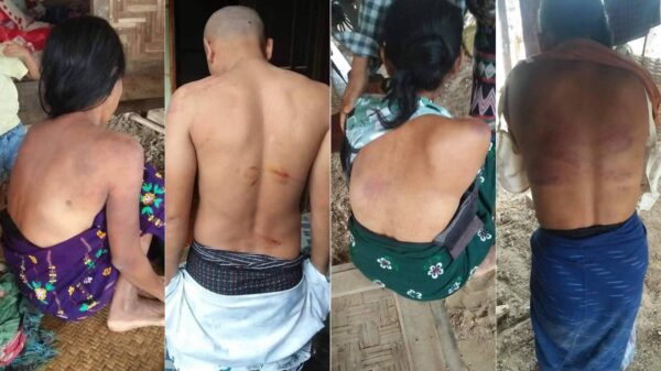 (ဒဏ်ရာများဖြင့် ထွက်ပြေးလွတ်မြောက်လာသူများအား တွေ့ရစဉ်။ ဓာတ်ပုံ - File Photo)