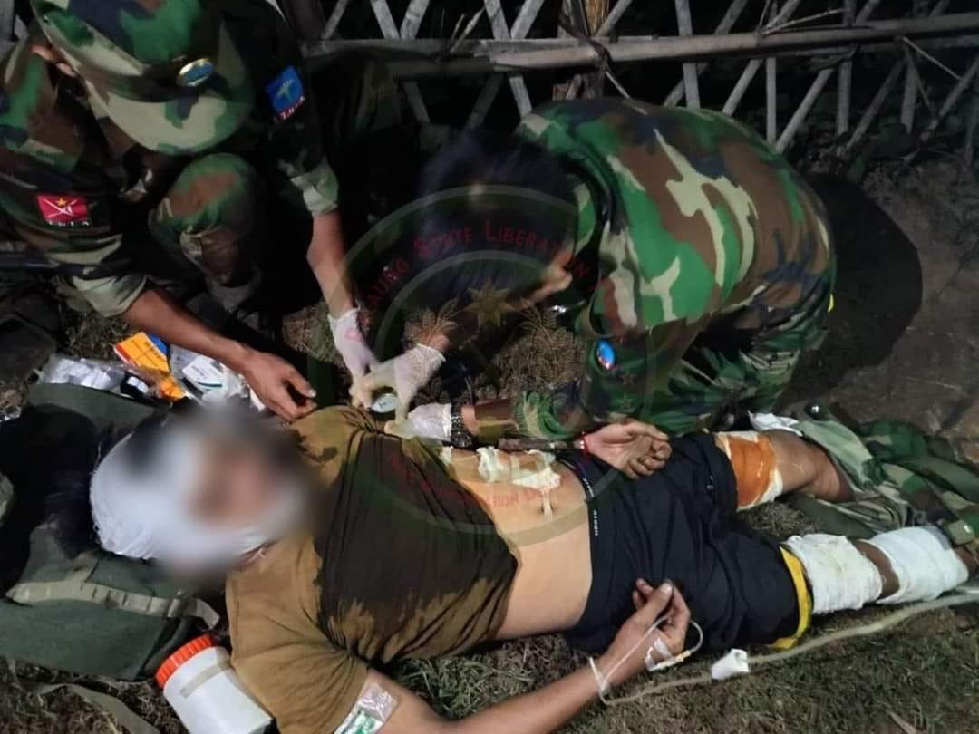 စစ်​ကောင်စီတပ်က ဗုံးကြဲတိုက်ခိုက်မှု​ကြောင့် ဒဏ်ရာရ​နေ​သော TNLA တပ်ဖွဲ့ဝင်အချို့ ကို ​ဆေးတပ်ဖွဲ့က ​ရှေးဦးသူနာပြုစုနည်းဖြင့် ကုသ​ပေး​နေစဥ်