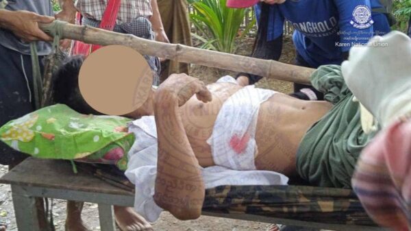 (အာဏာသိမ်းစစ်ကောင်စီတပ်က လက်နက်ကြီး ပစ်ခတ်မှုကြောင့် ထိခိုက်ဒဏ်ရာရသူတစ်ဦးအား တွေ့ရစဉ်။ ဓာတ်ပုံ - KNU)