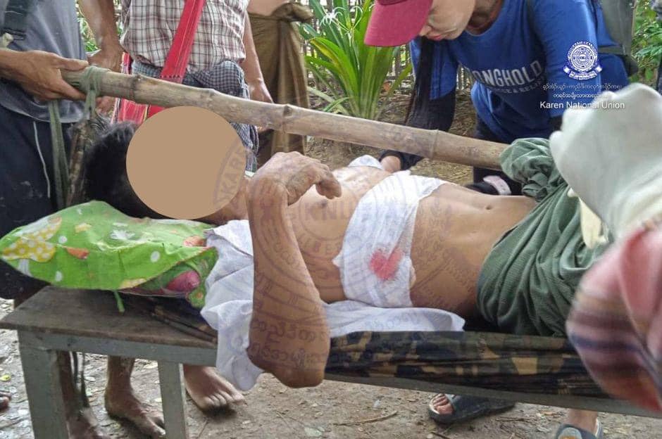 (အာဏာသိမ်းစစ်ကောင်စီတပ်က လက်နက်ကြီး ပစ်ခတ်မှုကြောင့် ထိခိုက်ဒဏ်ရာရသူတစ်ဦးအား တွေ့ရစဉ်။ ဓာတ်ပုံ - KNU)