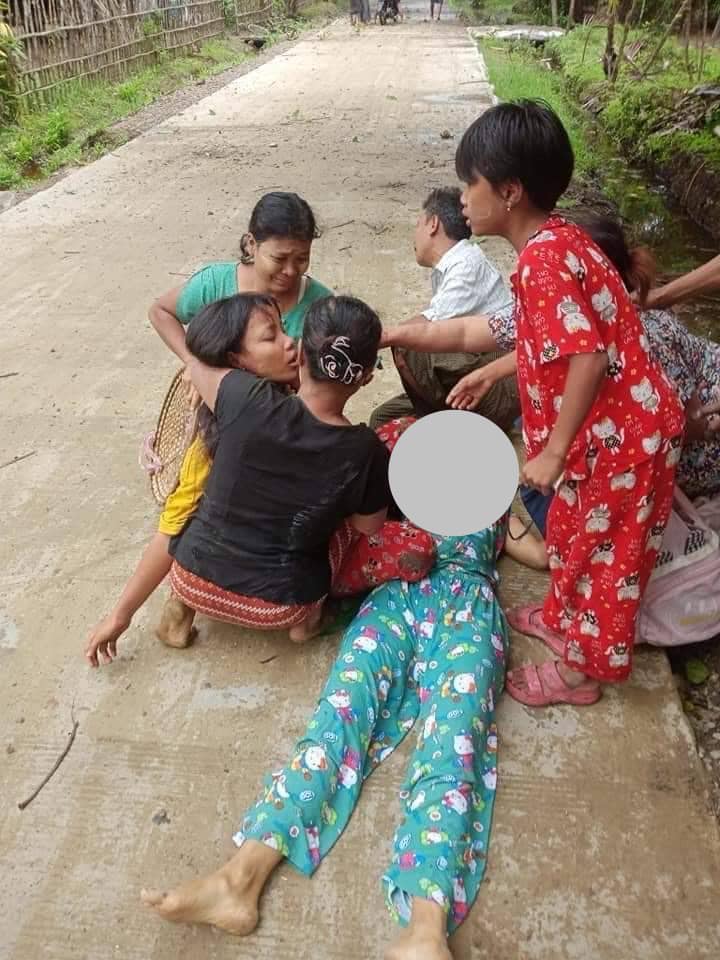 (စစ်ကောင်စီပစ်ခတ်တိုက်ခိုက်မှုကြောင့် ထိခိုက်ဒဏ်ရာရရှိသည့် အရပ်သားပြည်သူအချို့အား တွေ့ရစဉ်။ ဓာတ်ပုံ - CJ)